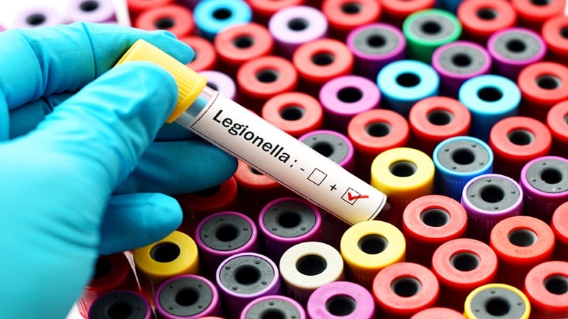 Respostes als dubtes més requerits sobre el nou decret per la prevenció i control de la legionel·losi